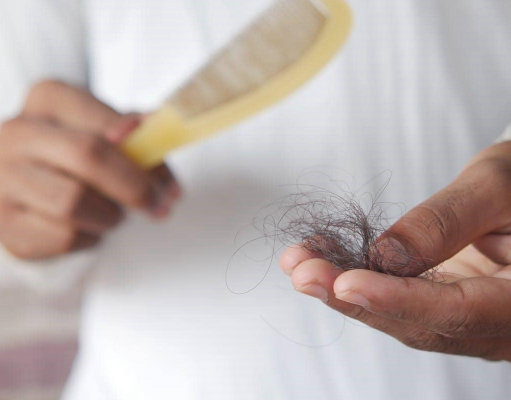 Apakah Rambut Rontok Bisa Tumbuh Kembali? Cek Penyebab dan Tandanya